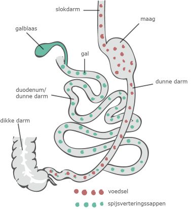 duodenal switch